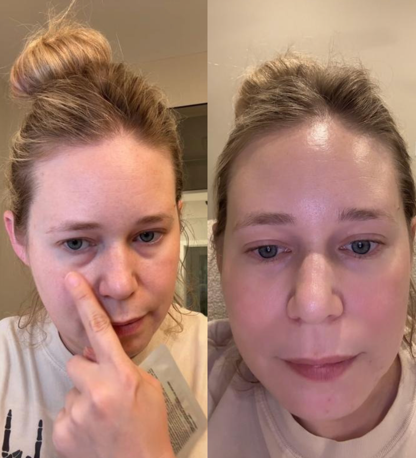 Lorendi InstantLift™ Collagen Patches