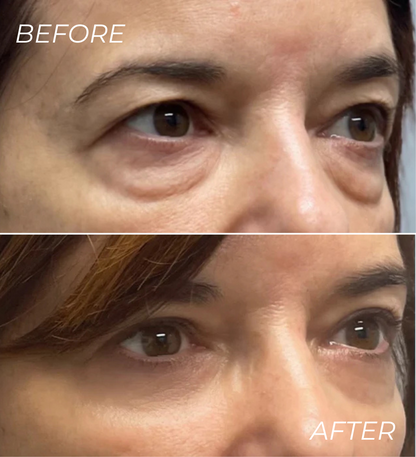 ALL-IN-ONE BALM FOR UNDER EYE RENEWAL