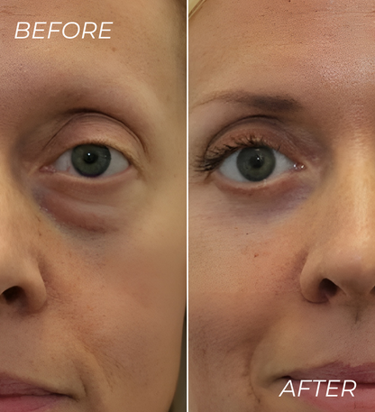 ALL-IN-ONE BALM FOR UNDER EYE RENEWAL