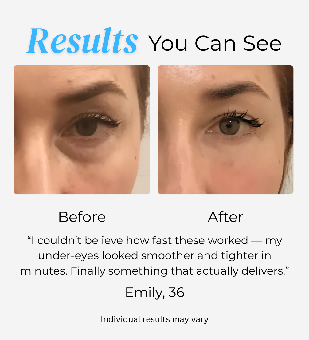 Lorendi InstantLift™ Collagen Patches