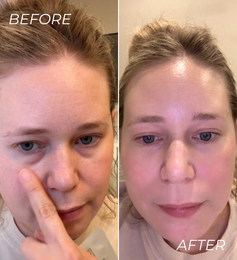 ALL-IN-ONE BALM FOR UNDER EYE RENEWAL