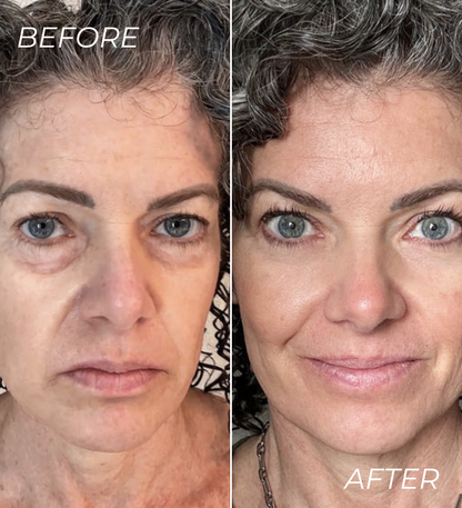 ALL-IN-ONE BALM FOR UNDER EYE RENEWAL