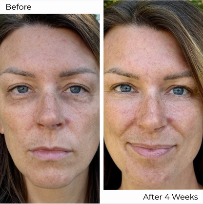 VoluCell™ - Micro-needle Patches