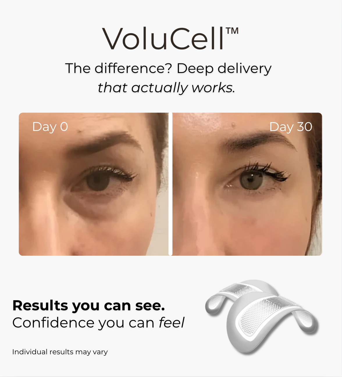 VoluCell™ - Micro-needle Patches