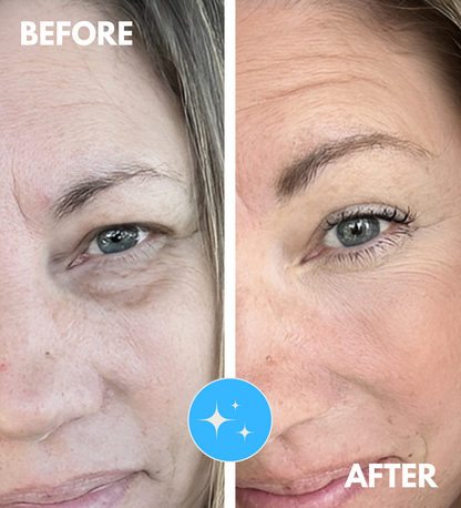 Lorendi InstantLift™ Collagen Patches